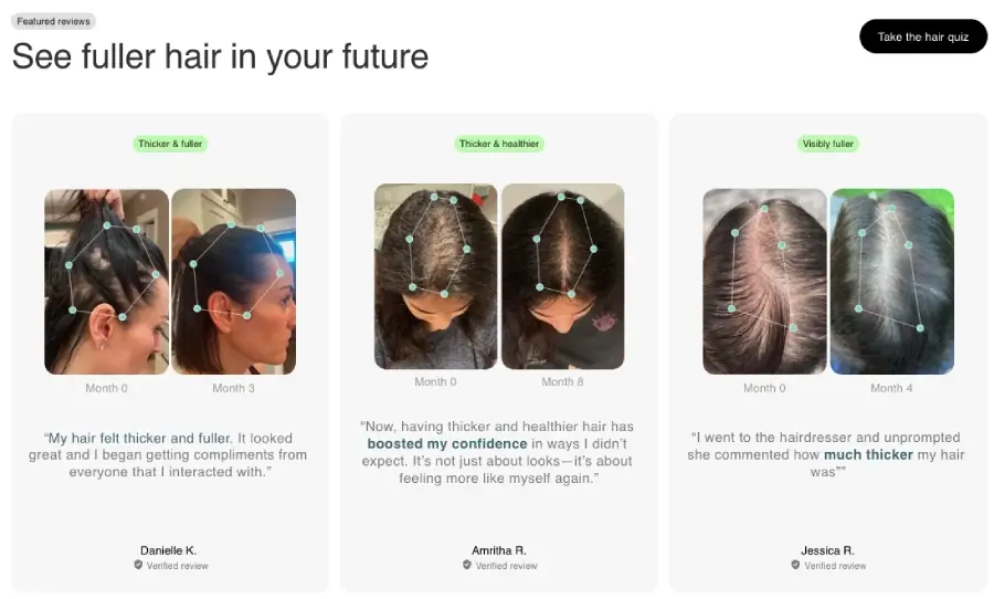 hers hair testimonials